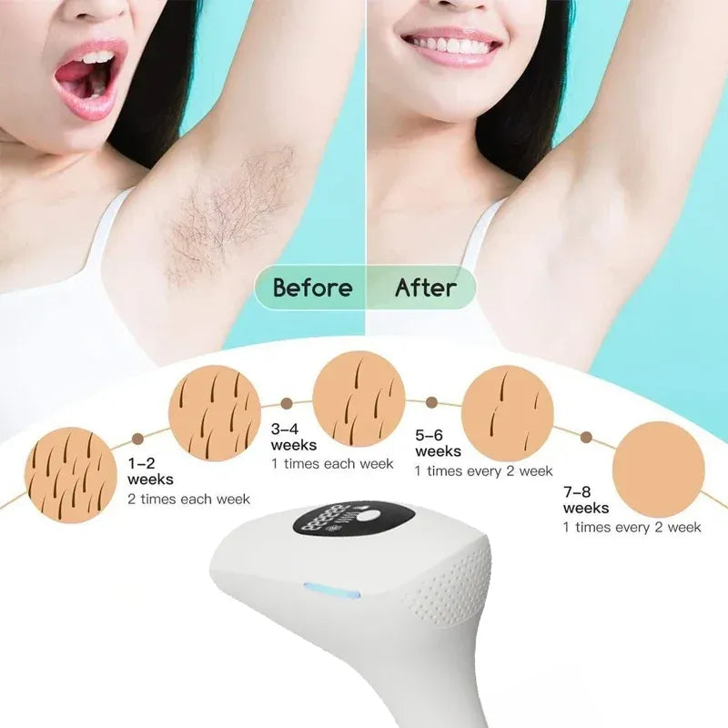 IPL Digital Laser Hair Removal Device with Auto Flash